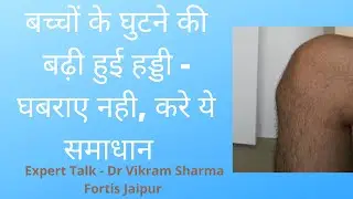 बच्चों के घुटने की बढ़ी हुई हड्डी -घबराए नही, करे ये समाधान  - Dr Vikram Sharma Fortis Jaipur.
