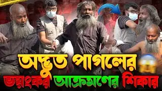 অদ্ভুত পাগলের ভয়ংকর আক্রমণের শিকার | Street Humanity of Bangladesh