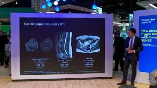 New perspectives. Bigger MRI impact with Compressed SENSE