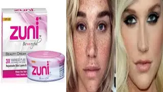 Zuni Whitening cream || Zuni Beauty Cream Review,Uses,Benefits and Price || zuni Anti Acne  Cream