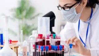 Manual Total Leukocyte Count , Haematology ,WBC Count,Tlc,blood cell count,#health #science#labtech