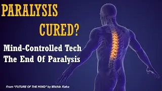Mind-Controlled Technology: The New Era of Spinal Injury Recovery