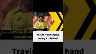 Travis Head&rsquo;s finger injury explained #travishead #cricketaustralia #cricket #fracture