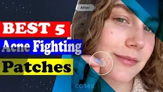 Top 5 Best Acne Fighting Patches 2025 | Fast & Effective Spot Treatments!