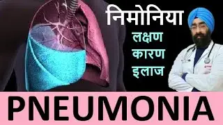 निमोनिया | What happens in Pneumonia | Symptoms & Treatment | Dr.Education Hindi + Eng subs