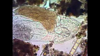 Коловратка (Rotatoria) под микроскопом under microscope