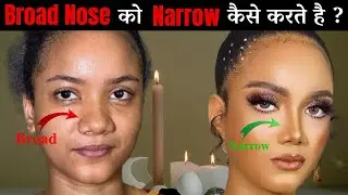 Broad Nose to Narrow Nose | Rhinoplasty | Dr Sunil Tanvar