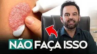 Você está tratando PSORÍASE errado e pode piorar tudo!