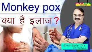 Monkey Pox क्या है इलाज ? | MONKEY POX VIRUS  FOR YOUR AWARENESS HOW IT IS TREAED