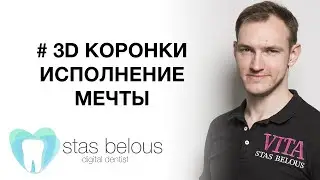 #Стоматолог Стас Белоус делаю #Виниры ИСПОЛНЕНИЕ МЕЧТЫ ПЕРЕДНИЕ ЗУБЫ Cerec crowns emax LT BL2 stains