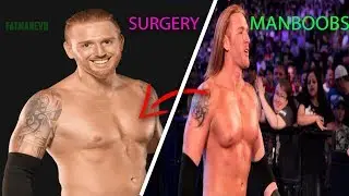 WWE Heath Slater And Gynecomastia - Manboobs Surgery Before And After. WWE And Gynecomastia