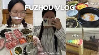 PLASTIC SURGERY in CHINA vlog🥺: (really emotional) mole removal, process, recovery, soft diet, etc