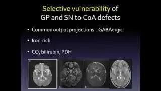 How defects in pantothenate metabolism cause neurodegeneration