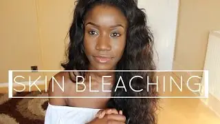 My Skin Bleaching Story ...