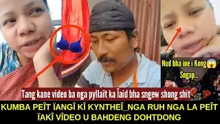 U Bahdeng dohtdong u nang tang ban sieh &iuml;a kiwei,Sieh shwa &iuml;a lade nai pat sieh &iuml;a kiwei_u long Thik