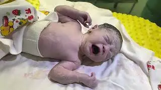 New baby delivery #humancub #babycub