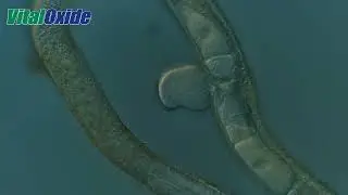 Vital Oxide vs Nematode
