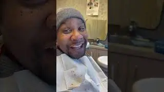 Upper All On 6 Dental Implants