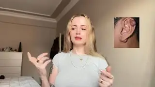Piercing Keloidi ve &Ccedil;&ouml;z&uuml;m&uuml; ✨