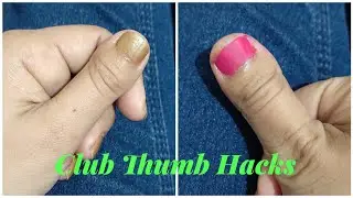 Hacks For Club Thumb || Wide Broad Thumb Tips