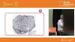 Q Fever. What is it? Who gets it? How to prevent it with Q Vax vaccination!