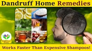 Dandruff Home Remedies | Stop the Flakes Forever #dandruffremedy