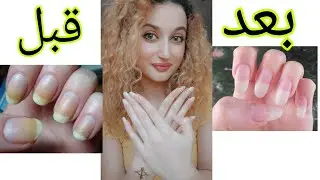 تجربتي مع تبييض الأظافر 💅نتيجة من أول استخدام | رهيييييبة 😍