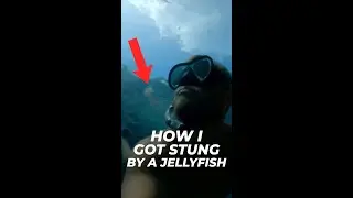 I GOT STUNG BY A JELLYFISH IN GREECE #shorts