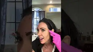 DIY Botox Injections | Face Mapping Tutorial