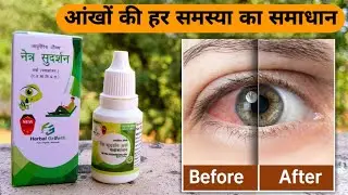नेत्र सुदर्शन अर्क आई ड्रॉप के फायदे | Netra Sudarshan Ark Eye Drop Benefits & Review After Use 