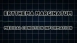 Erythema marginatum (Medical Condition)