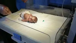 Newborn Baby Physiotherapy