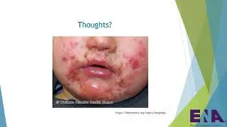 Bradley Rund - Navigating Pediatric Dermatological Emergencies