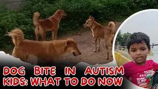 ఆటిజం పిల్లలను కుక్క కరిస్తే ఏమి చేయాలి | autism awareness |dog bite in autism kids|Karthik koppaka 