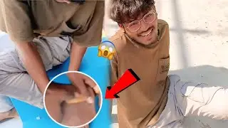 Aaj To Din Hi Kharab Tha 😰|  Bhayank चोट Lag गई |