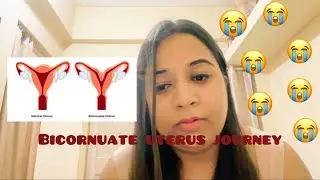 MY BICORNUATE UTERUS JOURNEY | EMOTION 😭