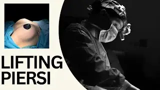 Lifting Piersi - czyli jędrniejszy i kształtny biust - OT.CO Clinic