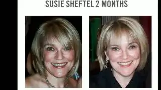 Dramatic Results With Rodan and Fields Soothe!