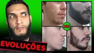 EVOLUÇÃO DOS INSCRITOS / MINOXIDIL #101 (antes e depois)