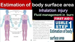 Estimation of body surface area & burn management in Hindi/Urdu by first aid for USMLE step 1