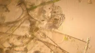 Chydoridae coming to life