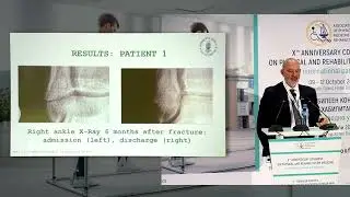 22. MECHANICAL VIBRATION ON PHYSICAL AND REHABILITATION MEDICINE
