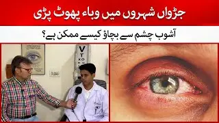 Flood Disaster in Pakistan Causes Eye Infection in Rural Areas of Pakistan | Pink Eye Infection