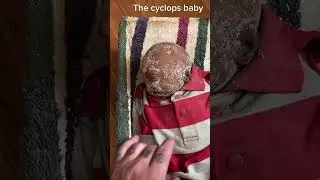 #wow Amazing #Cyclops Baby# Never Seen Before #