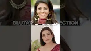 Did Kajal Aggarwal get plastic surgery?