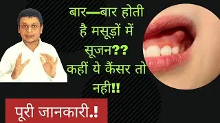 मसूड़ों में होती है बार-बार सूजन? कहीं कैंसर तो नहीं..?