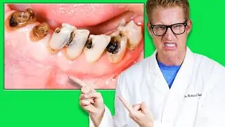 Dentist Reveals WHAT CAUSES CAVITIES & How to PREVENT TOOTH DECAY!