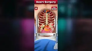 Open Heart Surgery Doctor Games | New Gameplay Trailer | Hospital Surgery Games
