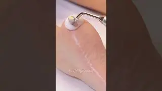 SATISFYING Foot Massage ASMR 😌 | Relaxing ASMR