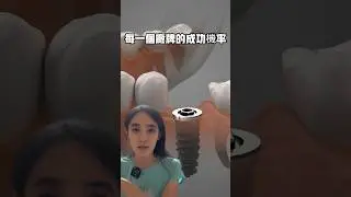 植牙廠牌價差大，選國際植牙大廠好還是便宜的就好#植牙